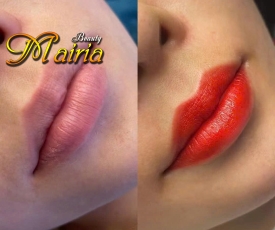 phun-moi-collagen-phun-may-dieu-khac-soi-nam-nu