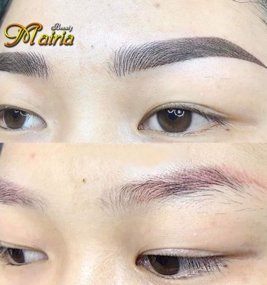 Quy trình thực hiện xoá sửa mày trổ xanh trổ đỏ 