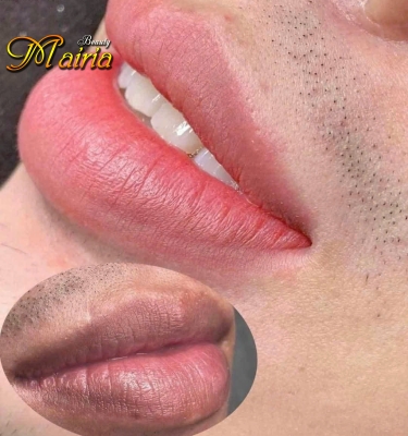 Khử thâm làm hồng môi nam