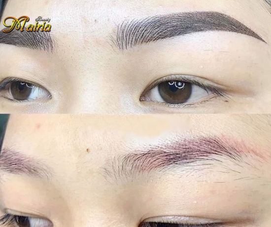 Quy trình thực hiện xoá sửa mày trổ xanh trổ đỏ 