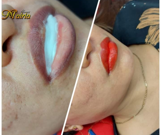 Phun môi collagen - phun mày điêu khắc sợi mày nam nữ 