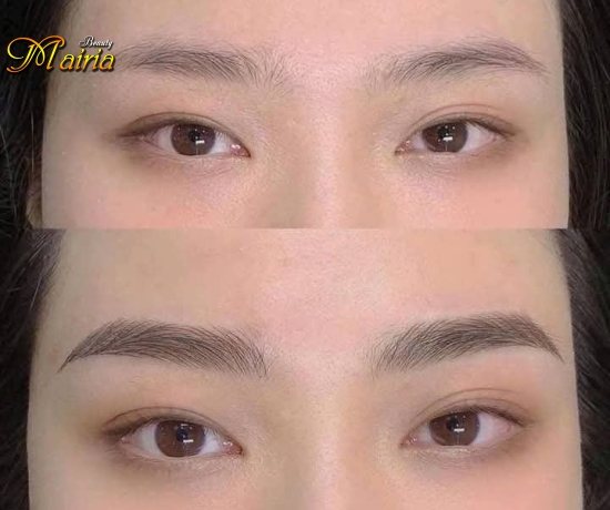 Xoá sửa mày trổ xanh trổ đỏ 