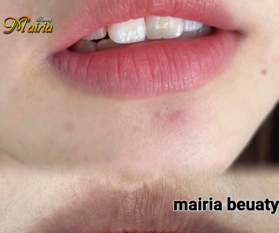 Phun môi collagen . Điêu khắc sợi mày 6D