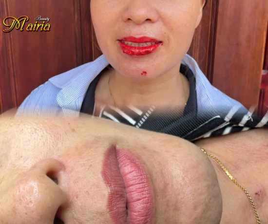 Phun môi collagen . Điêu khắc sợi mày 6D