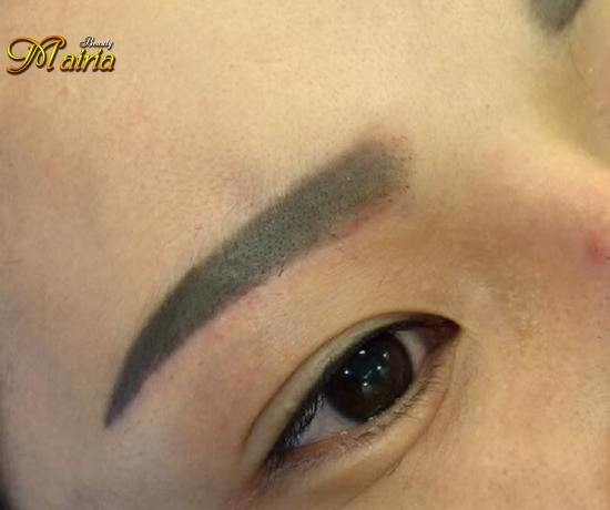 Quy trình thực hiện xoá sửa mày trổ xanh trổ đỏ 