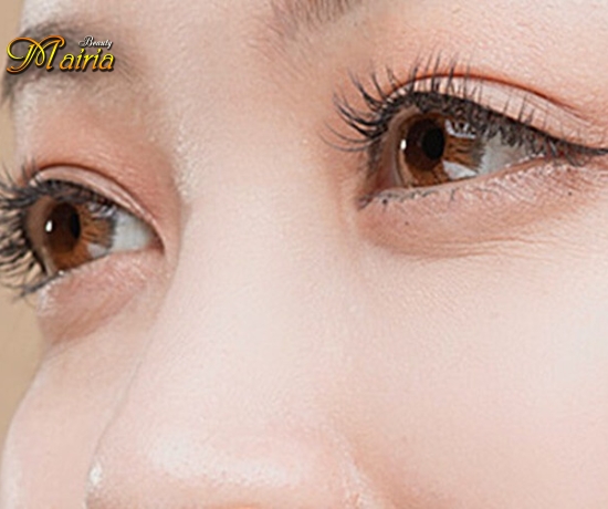 Phun mí mở tròng xoá sửa mí bị trổ xanh trổ đỏ 