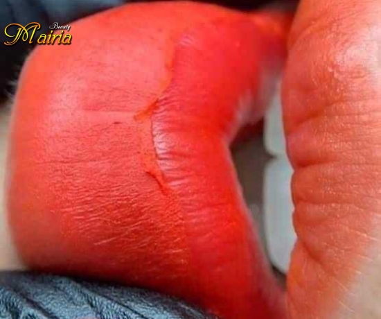 Phun môi collagen - phun mày điêu khắc sợi mày nam nữ 