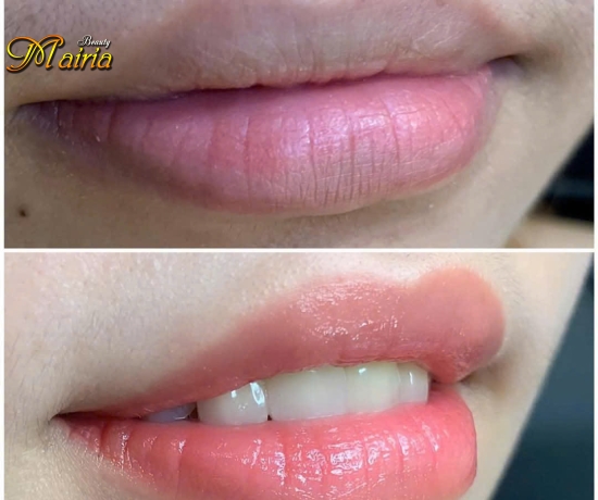 Khử thâm làm hồng môi nam